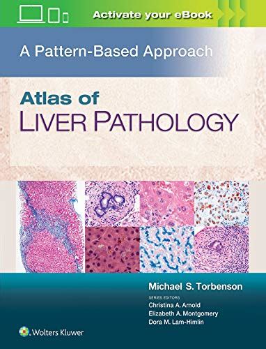 Atlas Of Liver Pathology A Pattern Based Approach Epubconverted Pdf