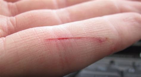 Heres Why Tiny Paper Cuts Make Your Finger Feel Like Its Going To