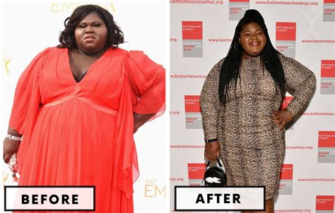 Top 21 Celebrity Weight Loss Surgery Transformations