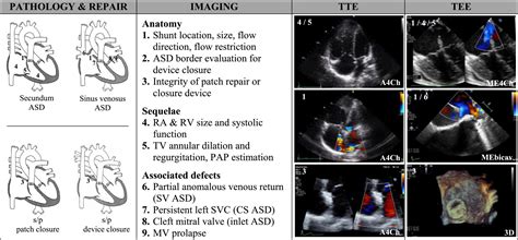 Perioperative Echocardiography In The Adult With Congenital Heart