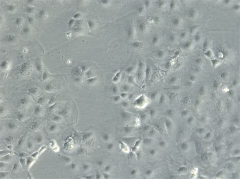 Caco 2 Cells