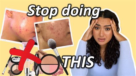 5 Mistakes To Avoid If Your Skin Is Purging Tretinoin Retin A