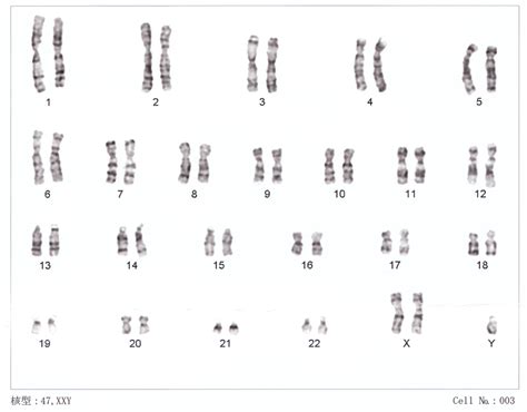 AnomalÍas CromosÓmicas On Emaze