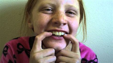 I've pureed my babies food for too long. How Many Teeth Should a 10 Year Old Have Lost? - YouTube