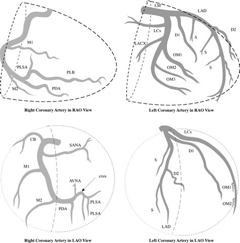 An algorithm for the core320 multicenter study. 7. Heart and Great Vessels | Radiology Review Manual ...