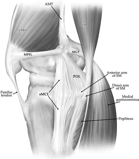 Imaging Of Athletic Injuries Of Knee Ligaments And Menisci Sports Imaging Series Radiology