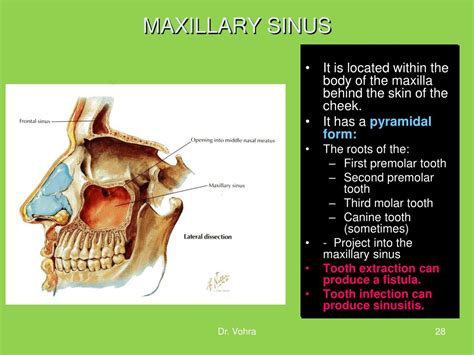 Ppt Nasal Cavity And Paranasal Sinuses Powerpoint Presentation Free
