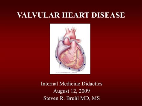 Valvular Heart Disease Ppt Captions Trending Update