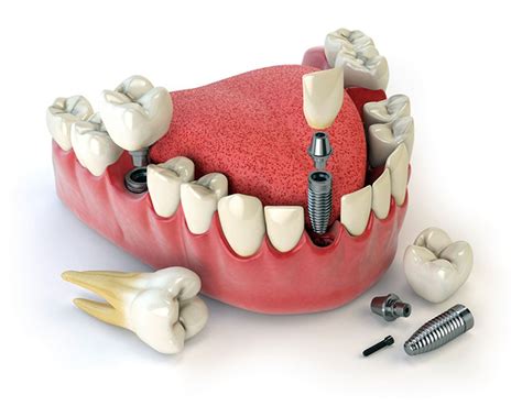 تخصصات طب الاسنان