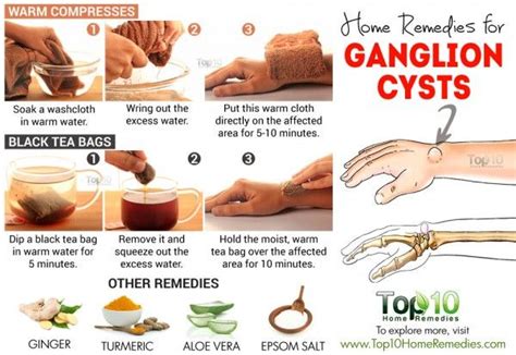 Les 25 Meilleures Idées De La Catégorie Ganglion Cyst Wrist Sur