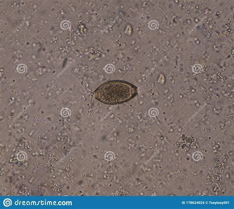 Yet this test comes with many limitations. Egg parasite in stool exam stock photo. Image of eggs - 178624024