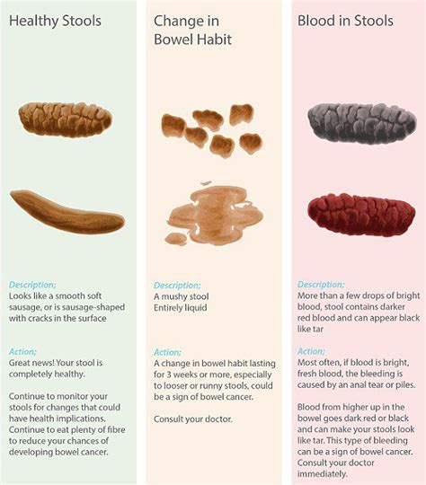 Colorectal cancers can often bleed into the digestive tract. GPs are missing basic signs and symptoms of bowel cancer ...