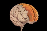 Lóbulo frontal: características y funcionamiento - Muy Salud