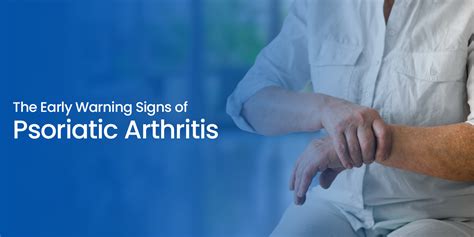 What Are The Early Warning Signs Of Psoriatic Arthritis
