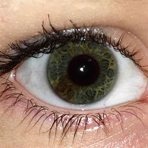 I Got Sectoral Heterochromia And Dark Green Eyes Reyes