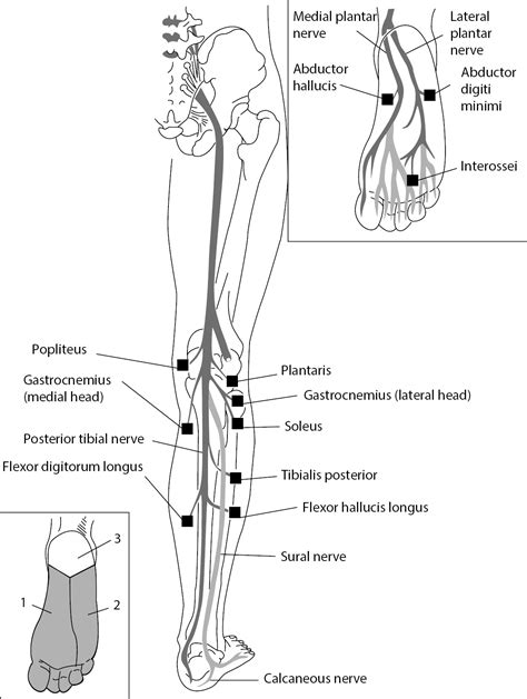 Tibial Nerve Injury Foot
