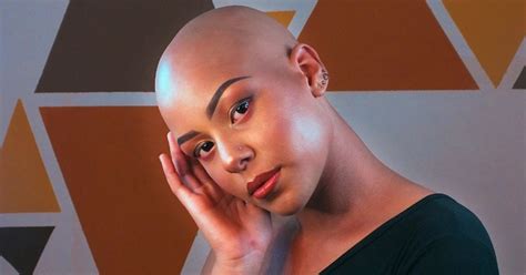 Alopecia Totalis Vs Alopecia Universalis Fondation Canadienne De Lalopécie Areata