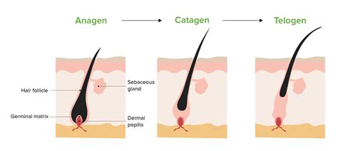 Alopecia Concise Medical Knowledge