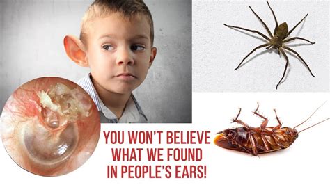 You Wont Believe What We Found In Peoples Ears Bug In Ear Symptoms