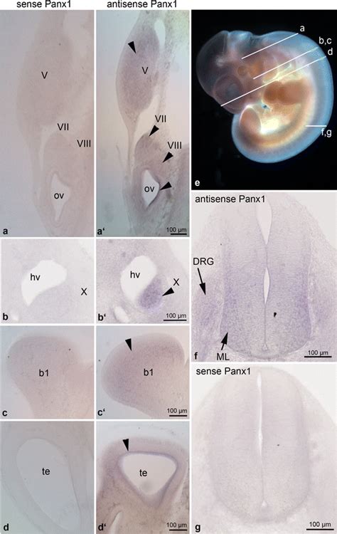 Cephalic And Truncal Transverse Vibratome Sections Of An E115 Embryo