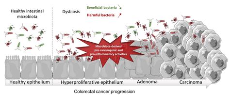 Ijms Free Full Text Microbiota Inflammation And Colorectal Cancer