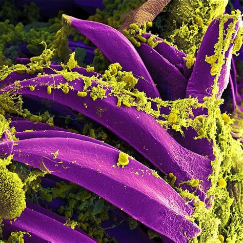 Microscope Bacteria Images Hd Micropedia