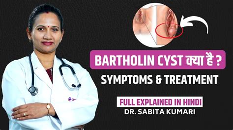 What Is Bartholin Cyst बरथलन ससट कय ह और इसक इलज कस