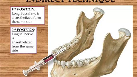Dental Nerve Anatomy