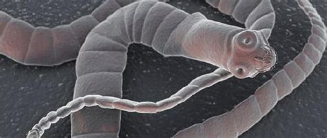 10 Most Dangerous Worms And Parasites That Can Live Inside You And Do This To Your Body