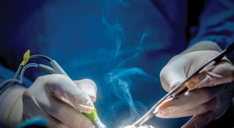 Cost Effective And Versatile Solutions For Surgical Smoke Evacuation