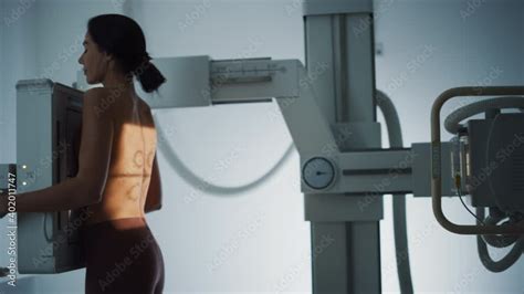 Hospital Radiology Room Beautiful Multiethnic Woman Standing Topless Next To X Ray Machine