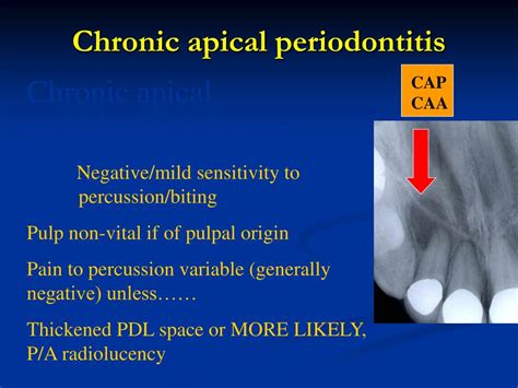 Ppt D435 Endodontics I Powerpoint Presentation Free Download Id