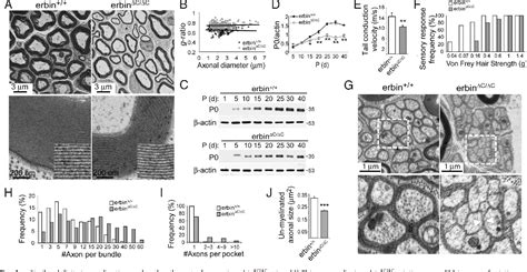 Figure 1 From Erbin Regulates NRG1 Signaling And Myelination Semantic