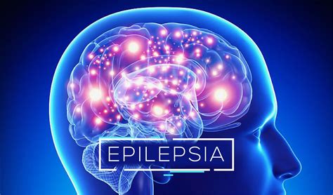 Epilepsia Clínica Pueyrredon