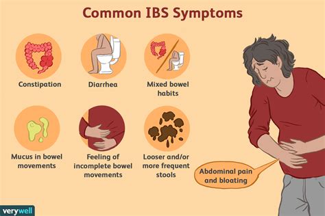 Irritable Bowel Syndrome Bloating