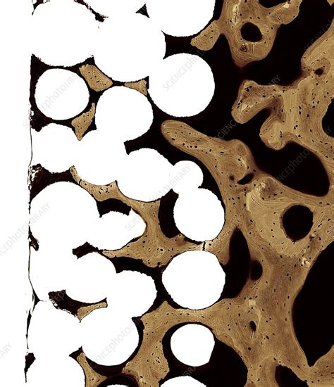 Two types of bone tissues in cross section of a long bone : Bone cross-section, SEM - Stock Image - C019/5248 ...
