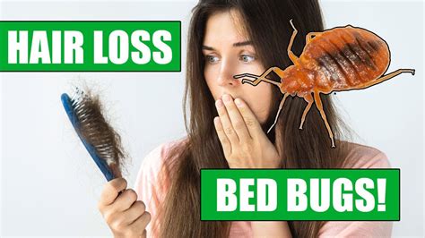 Do Bed Bugs Cause Hair Loss A Story Of Bed Bugs And Hair Loss What