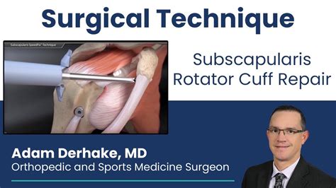 Subscapularis Rotator Cuff Repair Surgical Technique Youtube