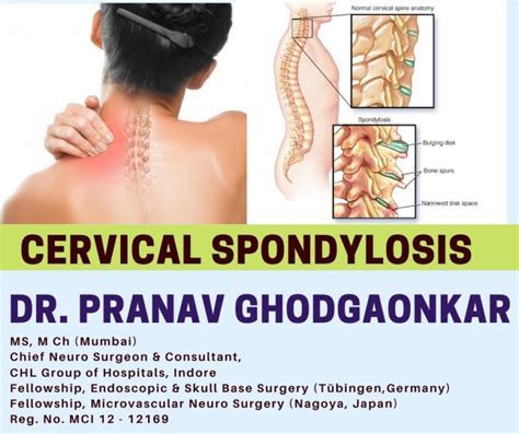 Cervical Spondylosis Dr Pranav Ghodgaonkar Anaya Clinic