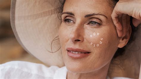 How Do I Naturally Get Rid Of Age Spots Sun Spots Liver Spots