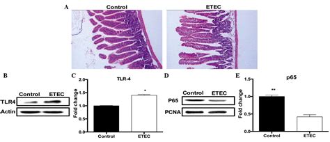 Enterotoxigenic Escherichia Coli Infection Alters Intestinal Immunity