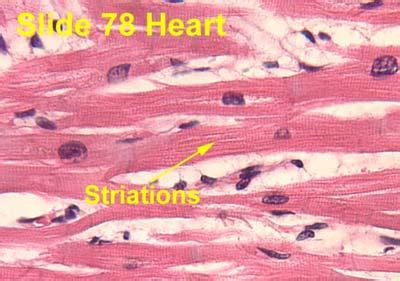 Cardiac Muscle Under Microscope Labeled Micropedia