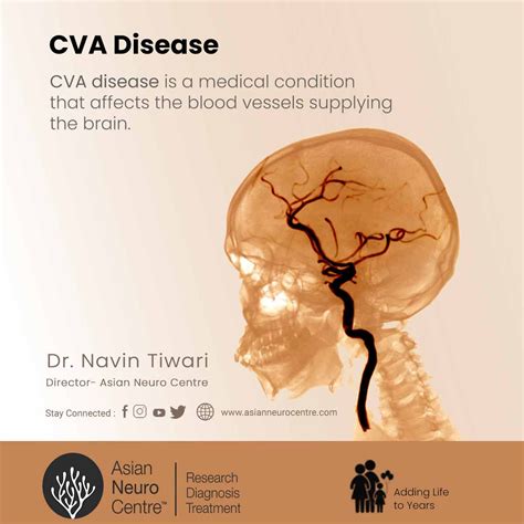 What Is Cerebrovascular Accident Cva Disease Symptoms Causes Treatment