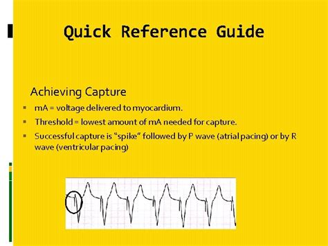 Temporary Transvenous Pacemaker Insertion Return To Procedures Temporary