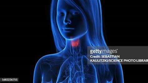 Hashimotos Disease Photos And Premium High Res Pictures Getty Images