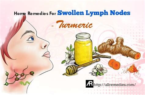 How To Treat Swollen Lymph Nodes In Neck Naturally 12 Ways Images And