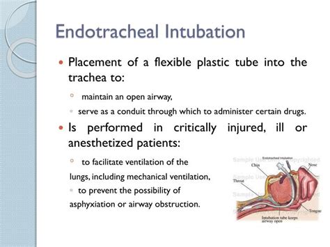 Ppt Airway Intubation Powerpoint Presentation Id2894259