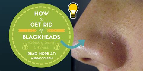 In addition, it works as abrasive to clear the dirt in the skin pores. How To Get Rid of Blackheads - Ang Savvy