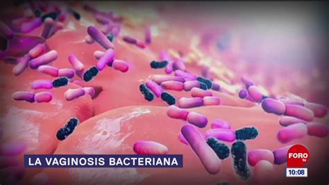 Vaginosis Bacteriana Noticieros Televisa