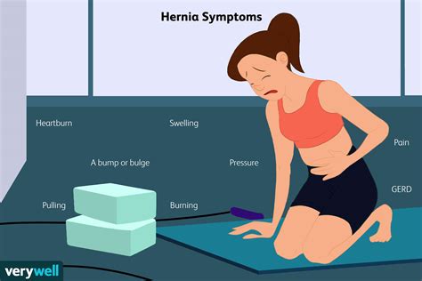 ¿qué Es Una Hernia Medicina Básica